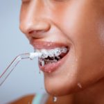 ¿Qué irrigador dental debería utilizar? Recomendaciones de la Clínica Dental Galindo