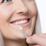 La sonrisa perfecta: las carillas dentales