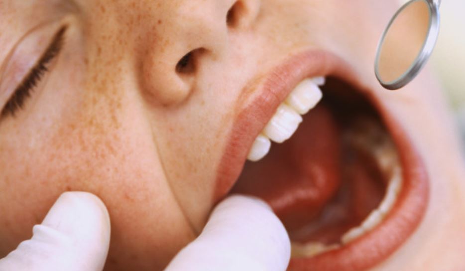 Odontopediatría: los dientes de leche pueden necesitar empastes y reconstrucciones