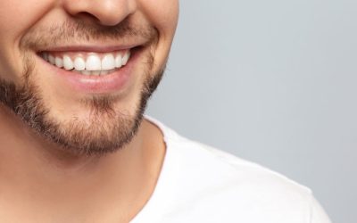 Carillas dentales: «Así recuperé mi sonrisa»